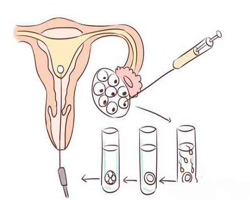 东莞做供卵试管 在东莞人民医院做试管需要出示什么证件? ‘酒精测男女有人测