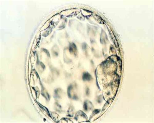 育儿书籍_育儿,女性不孕不育的原因有哪些？造成女性不孕的原因你占了几个