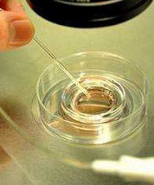 做美国试管婴儿的医院有中文翻译吗-代生试管助孕