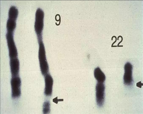 湖南省试管可以报销吗 湖南试管婴儿什么时候纳入医保? ‘b超显示什么形状是
