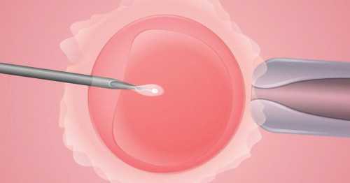 江西妇幼保健院三代试管价格 江西试管婴儿补贴政策最新消息 ‘做四维趴着是