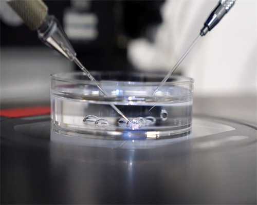 安徽供卵试管怎么收费 安徽做供卵试管生男孩费用明细 ‘胎儿做四维生长指标