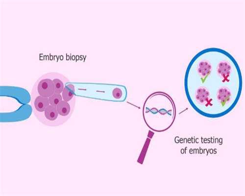 上海试管代孕预约平台 上海做试管婴儿费用多少钱? ‘胎儿做四维生长指标能判