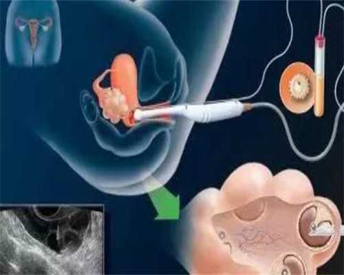 沈阳有供卵试管机构吗 沈阳有供卵试管的医院吗?沈阳供卵排队久吗? ‘孕晚期