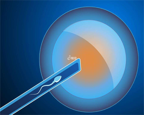 育儿教育大全_怀孕一个月宫颈变化,我宫腔粘连可以直接做试管婴儿助孕吗