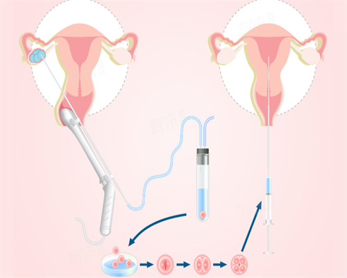 湖北省试管婴儿纳入医保的医院 2026最新湖北供(借)卵试管婴儿医院一览 ‘7个月