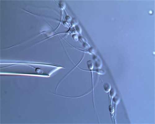 -子宫性不孕-代孕方案套餐